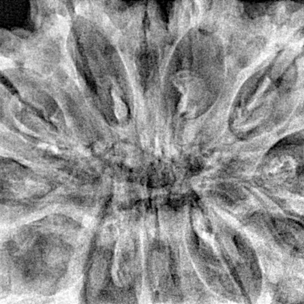 12 Mukhi Rudraksha 39.9mm 10.51gm - Xray