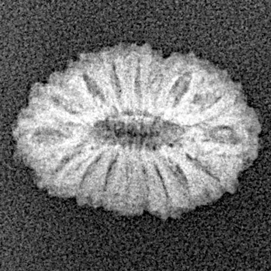 17 Mukhi Rudraksha 16.8mm 1gm - Xray