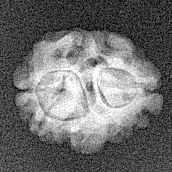 2 Mukhi Rudraksha 15.7mm 1.26gm - Xray