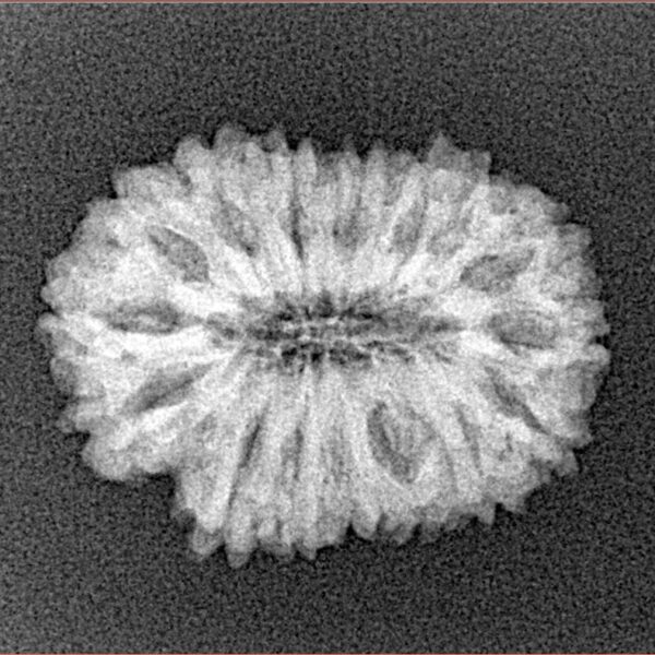 16 Mukhi Rudraksha 22.2mm 2.39gm - Xray