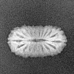 20 Mukhi Rudraksha 17mm 0.77gm - Xray