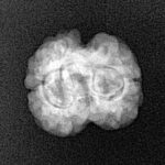 2 Mukhi Rudraksha 22.4mm 1.89gm - Xray
