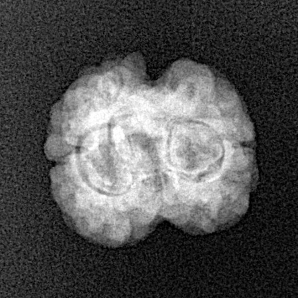 2 Mukhi Rudraksha 22.4mm 1.89gm - Xray