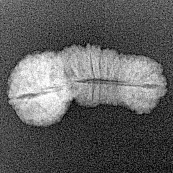 31 Mukhi Rudraksha 21.2mm 1gm - Xray