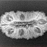 25 Mukhi Rudraksha 27.3mm 2.54gm - Xray