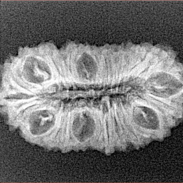 25 Mukhi Rudraksha 27.3mm 2.54gm - Xray