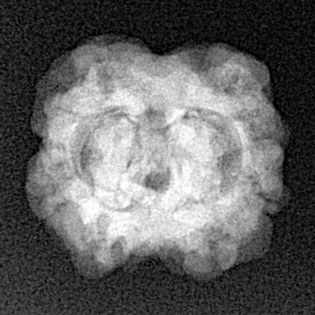 2 Mukhi Rudraksha 24.5mm 2.4gm - Xray