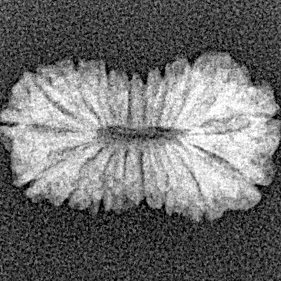 17 Mukhi Rudraksha 18.3mm 0.94gm - Xray