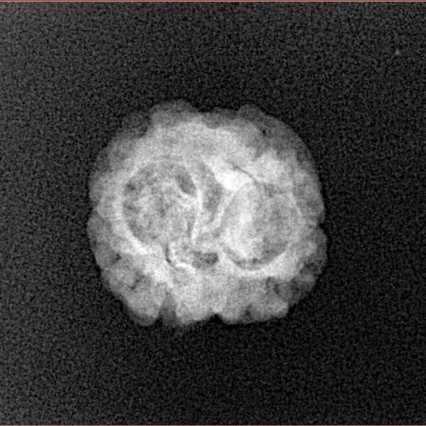 2 Mukhi Rudraksha 22.7mm 1.78gm - Xray