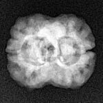 2 Mukhi Rudraksha 24.6mm 2.26gm - Xray