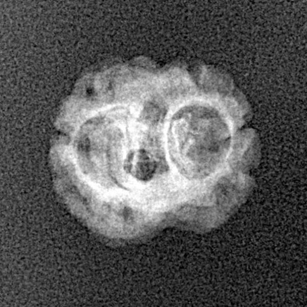 2 Mukhi Rudraksha 18.1mm 0.85gm - Xray