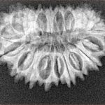 21 Mukhi Rudraksha 30.3mm 4.11gm - Origin: Nepal - Xray