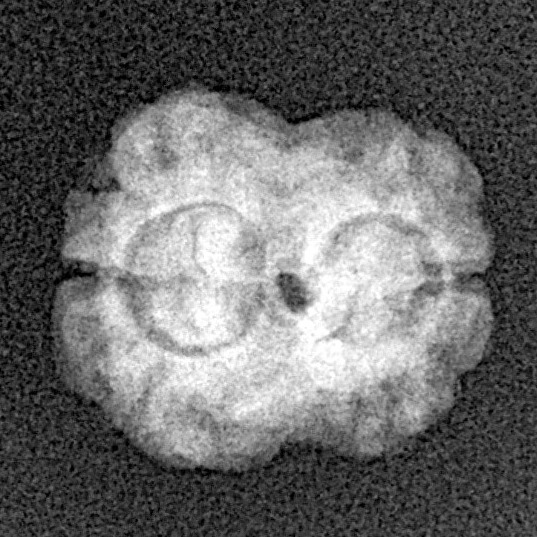 2 Mukhi Rudraksha 17.4mm 1.46gm - Xray