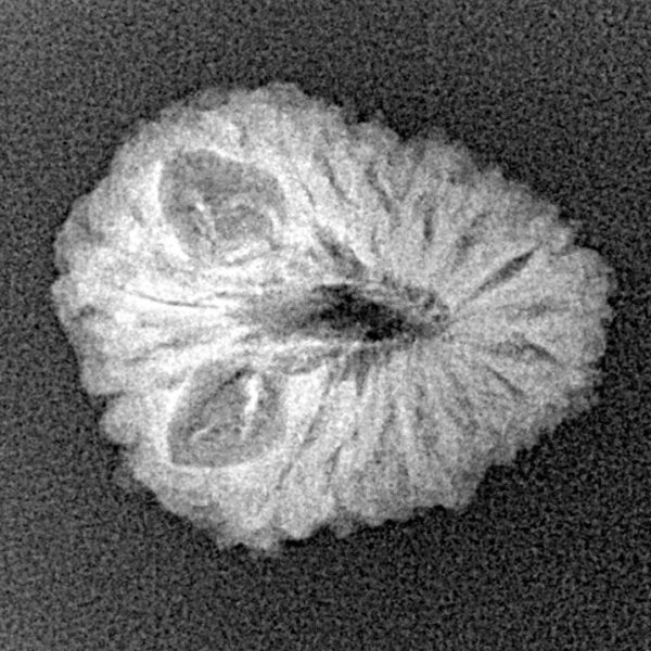 16 Mukhi Rudraksha 20.3mm 1.73gm - Xray