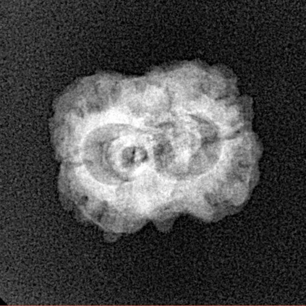 2 Mukhi Rudraksha 20.3mm 1.7gm - Xray