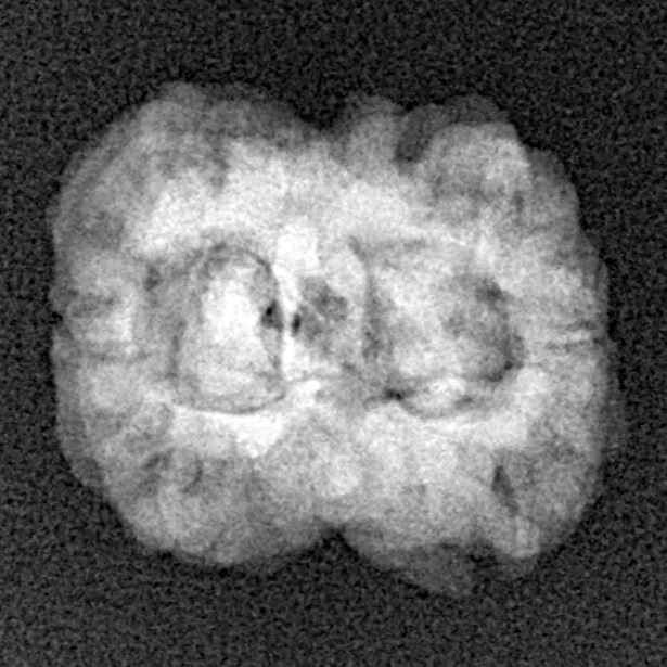 2 Mukhi Rudraksha 23.6mm 2.37gm - Xray