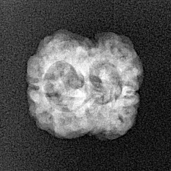 2 Mukhi Rudraksha 20.2mm 1.92gm - Xray