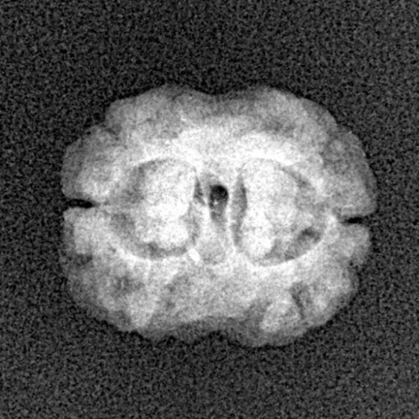 2 Mukhi Rudraksha 17.8mm 1.48gm - Xray
