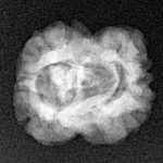 2 Mukhi Rudraksha 23.1mm 2gm - Origin: Nepal - Xray