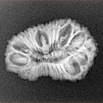 22 Mukhi Rudraksha 23.8mm 2.07gm - Xray
