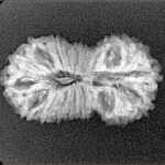 19 Mukhi Rudraksha 25.3mm 2.11gm - Xray