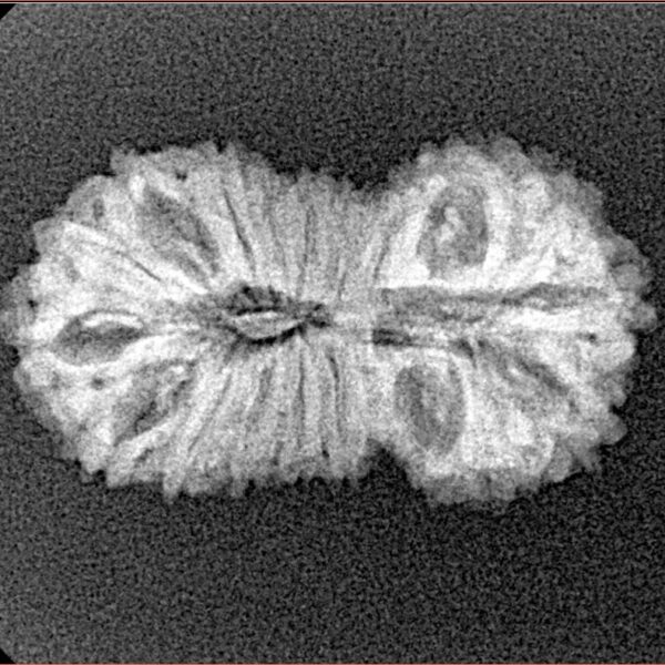 19 Mukhi Rudraksha 25.3mm 2.11gm - Xray