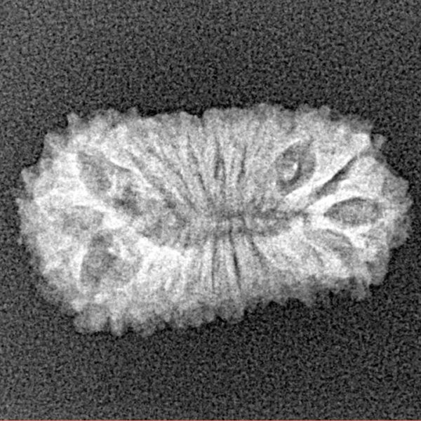 21 Mukhi Rudraksha 22mm 1.62gm - Xray