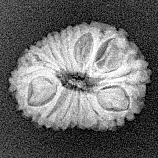 15 Mukhi Rudraksha 19.3mm 1.84gm - Xray