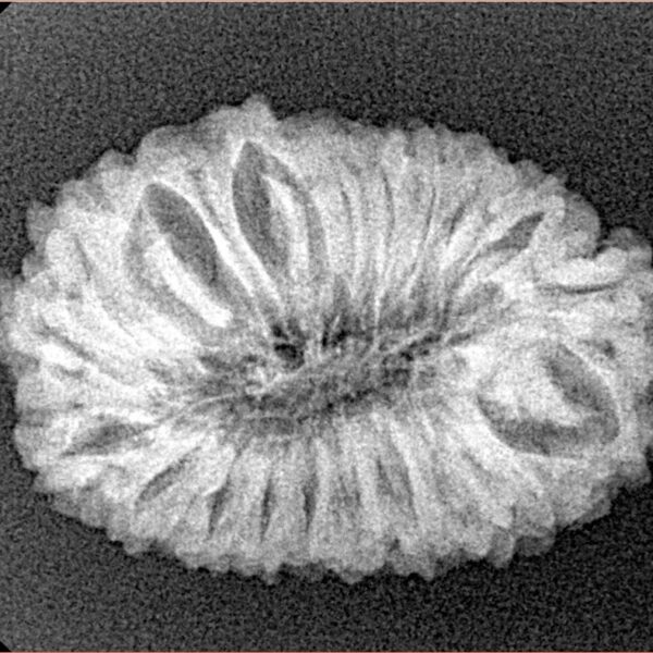 18 Mukhi Rudraksha 26.6mm 3.28gm - Xray
