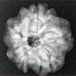 1MK(Underdeveloped) 22.3mm 3.68gm - Xray