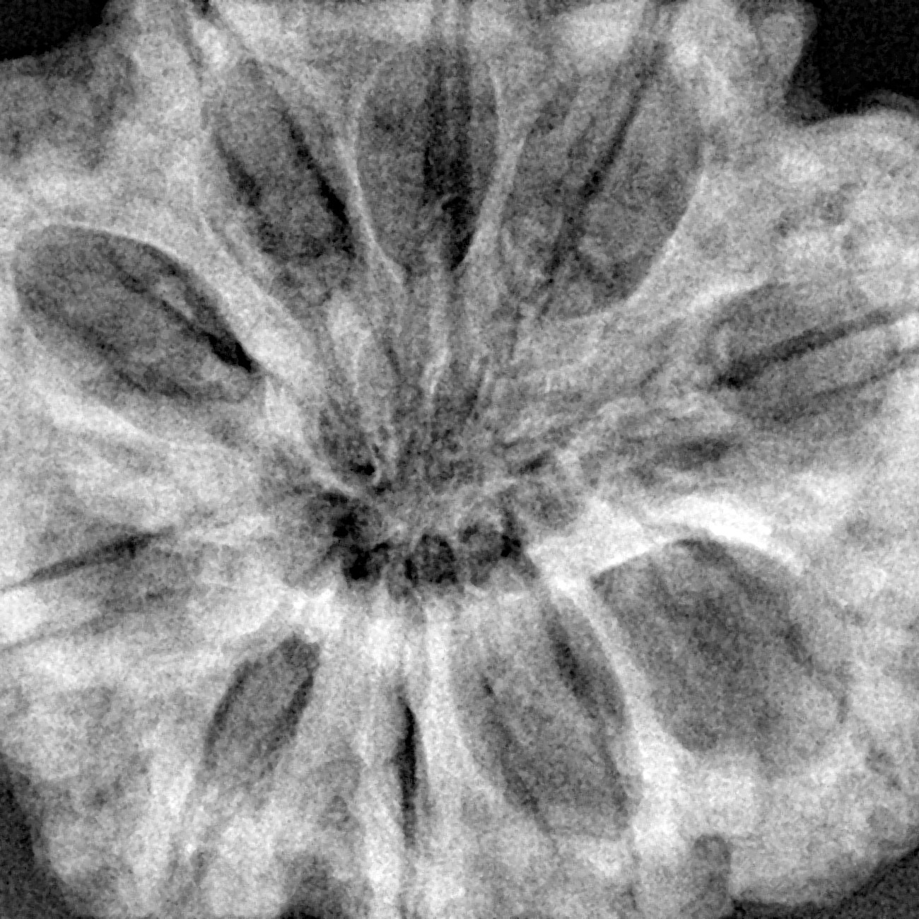 10 Mukhi Rudraksha 33mm 10.26gm - Xray