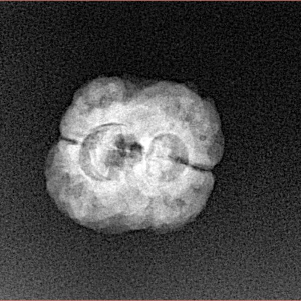 2 Mukhi Rudraksha 22.6mm 2gm - Xray