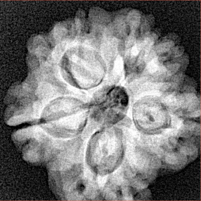 1MK(Underdeveloped) 22.6mm 3.78gm - Xray