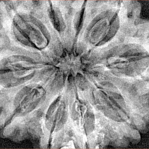 10 Mukhi Rudraksha 33.9mm 7.92gm - Xray