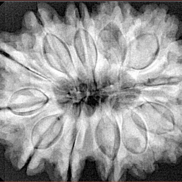 12 Mukhi Rudraksha 33.5mm 7.82gm - Xray