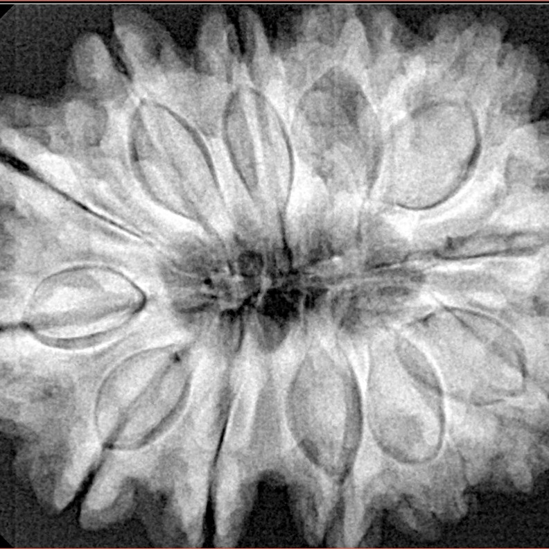 12 Mukhi Rudraksha 33.5mm 7.82gm - Xray