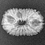16 Mukhi Rudraksha 20.4mm 1.3gm - Xray