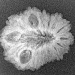 16 Mukhi Rudraksha 23.2mm 1.9gm - Xray