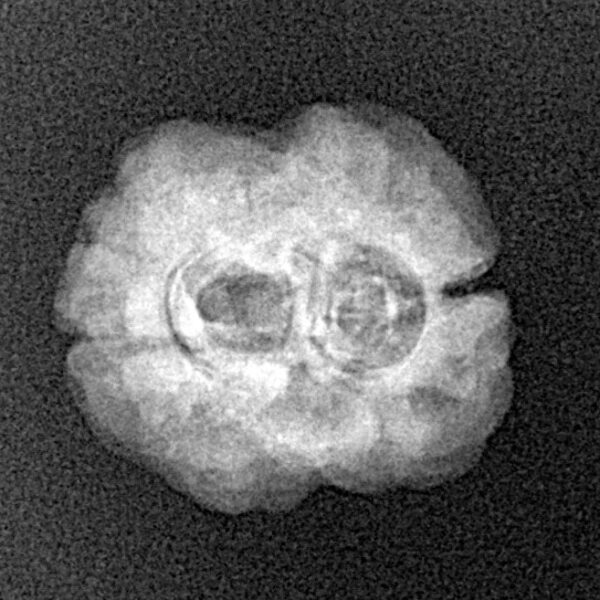 2 Mukhi Rudraksha 23.4mm 1.84gm - Xray