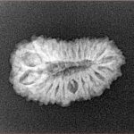 20 Mukhi Rudraksha 22.4mm 2gm - Xray