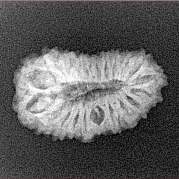 20 Mukhi Rudraksha 22.4mm 2gm - Xray