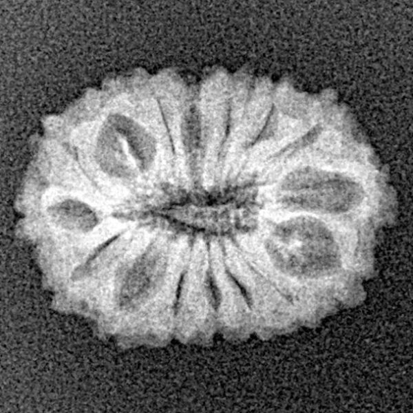 16 Mukhi Rudraksha 18.2mm 1.23gm - Xray