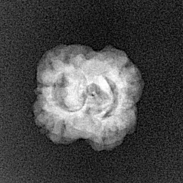 2 Mukhi Rudraksha 19.8mm 1.51gm - Xray