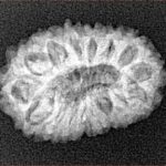 16 Mukhi Rudraksha 20.6mm 2gm - Xray