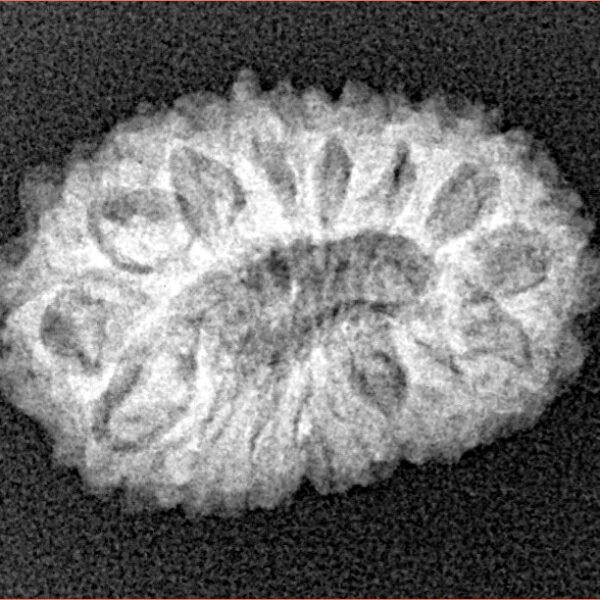 16 Mukhi Rudraksha 20.6mm 2gm - Xray