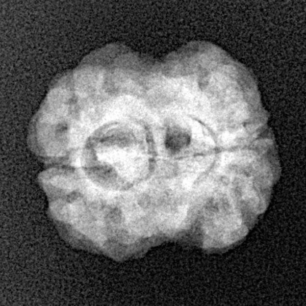 2 Mukhi Rudraksha 20.1mm 2.3gm - Xray