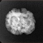 2 Mukhi Rudraksha 22.4mm 2.51gm - Xray