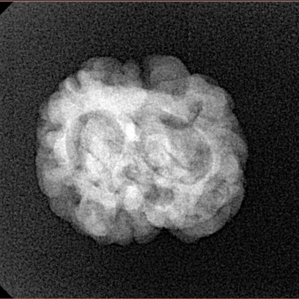2 Mukhi Rudraksha 22.4mm 2.51gm - Xray