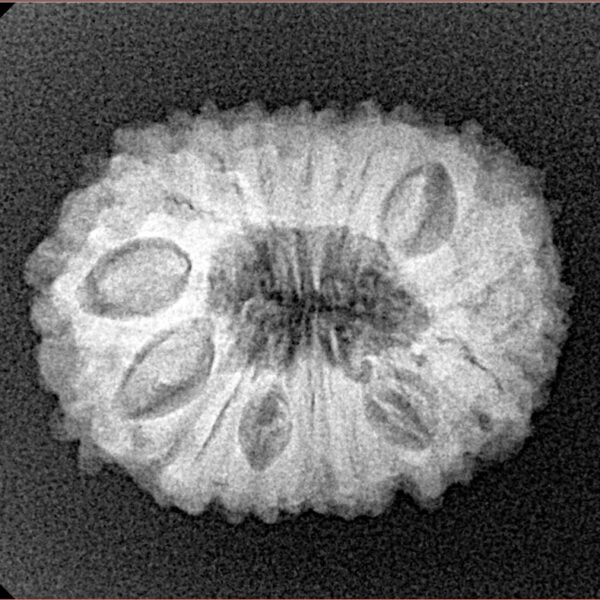 16 Mukhi Rudraksha 23mm 3.09gm - Xray