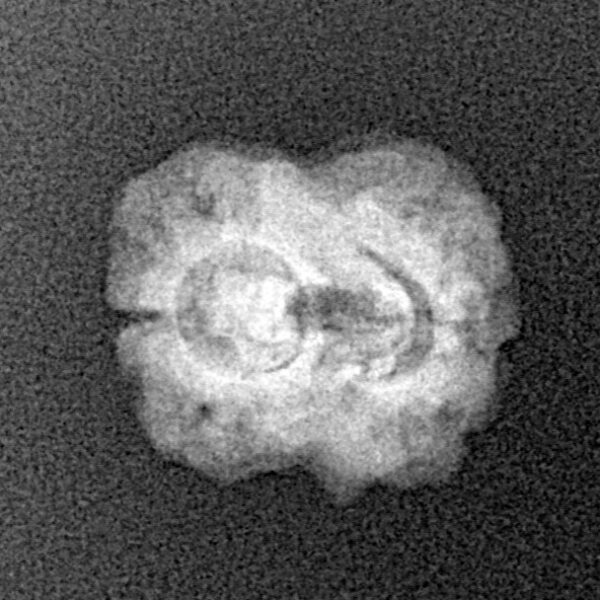 2 Mukhi Rudraksha 19mm 1.29gm - Xray